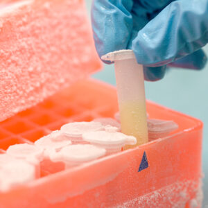 Réfrigération et cryogénisation